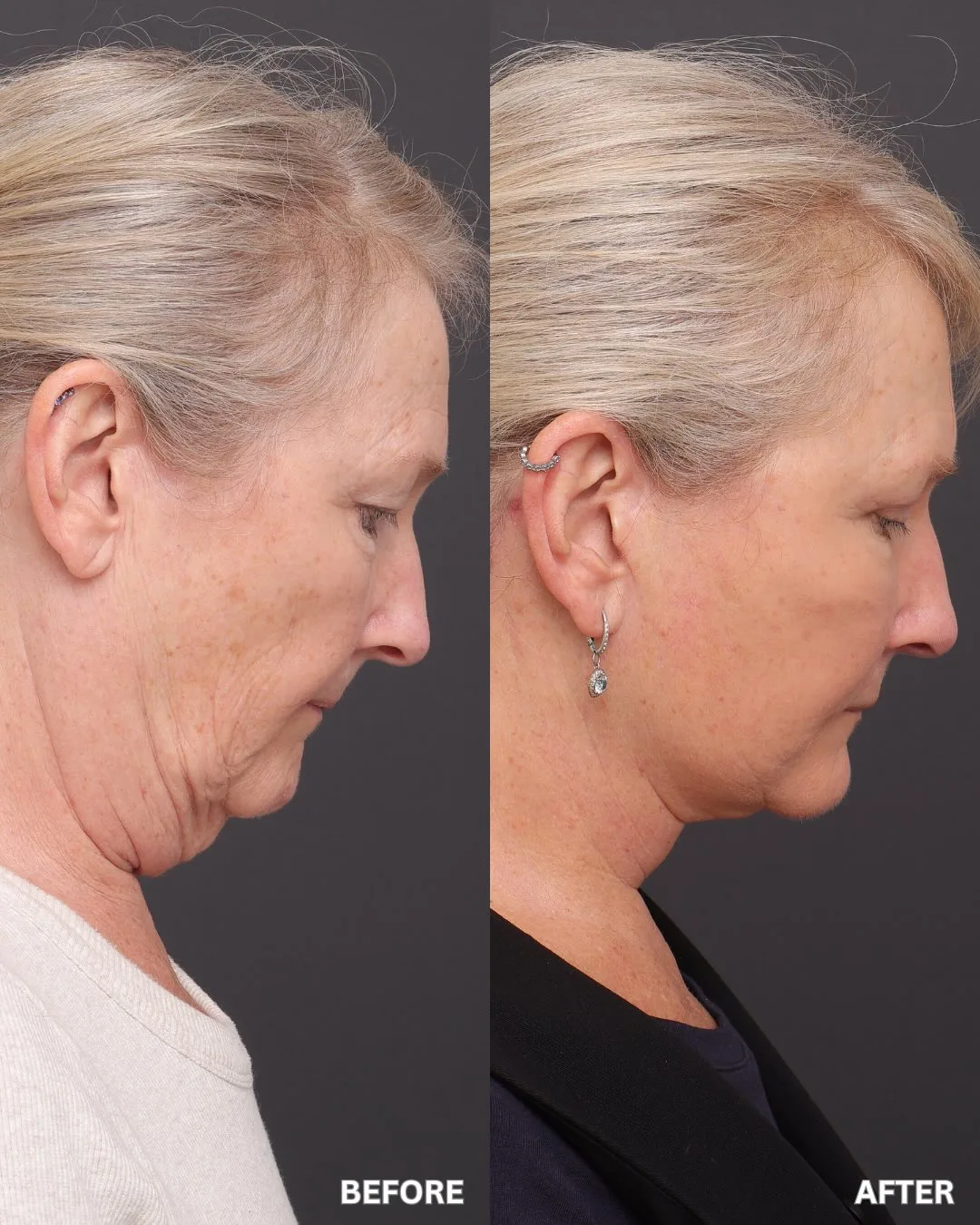 Before and after — Prof. Sydney Ch'ng