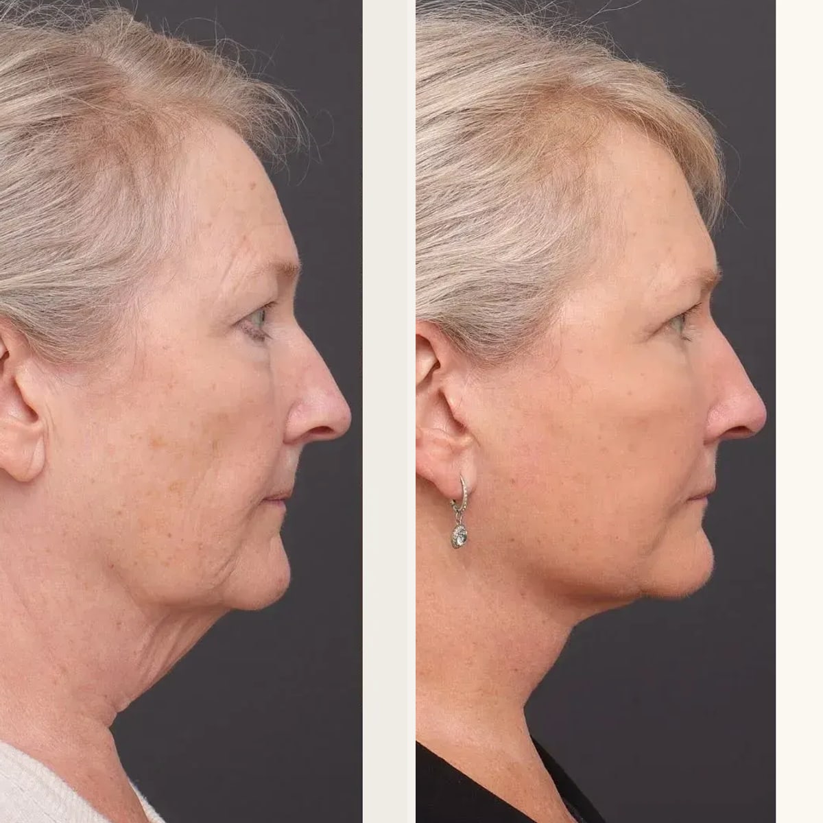 Before and after: Prof. Sydney Ch'ng