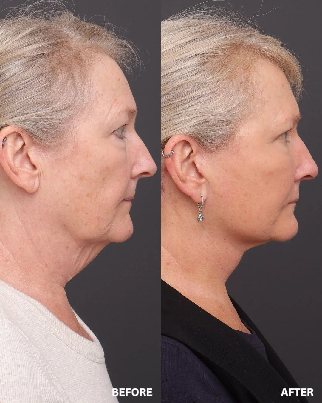 Before and after — Prof. Sydney Ch'ng