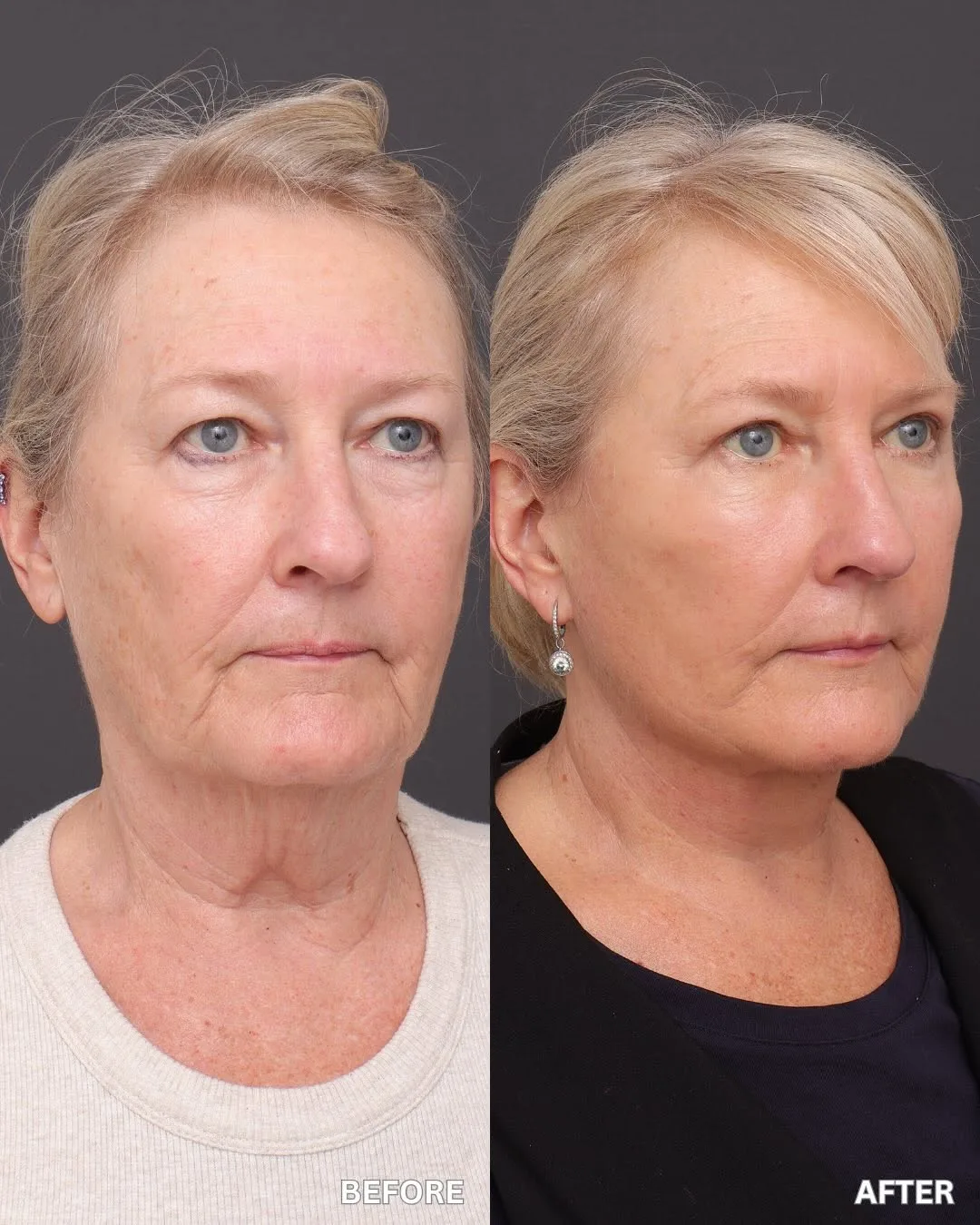 Before and after — Prof. Sydney Ch'ng