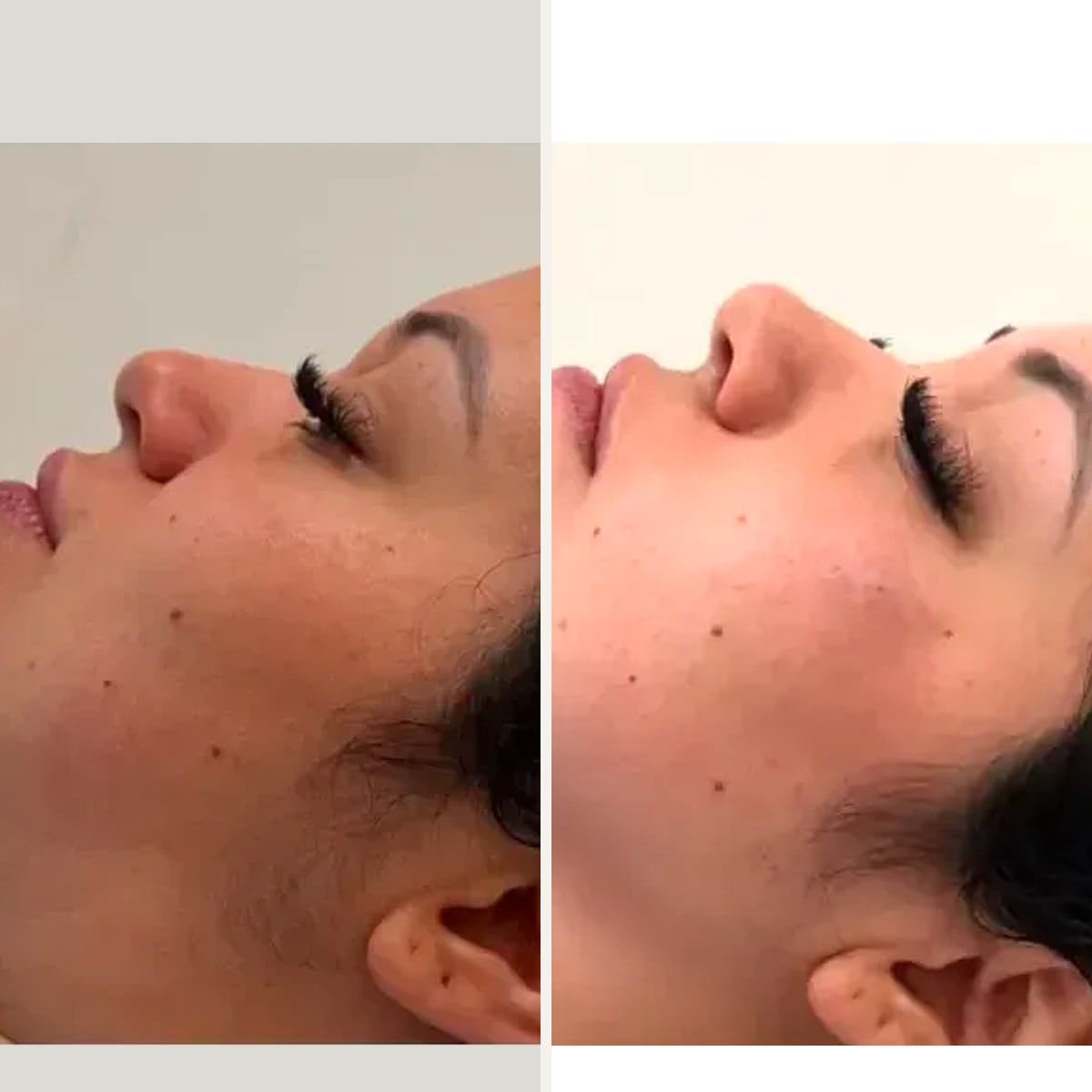 Before and after: Dr. Tainá Fritzen
