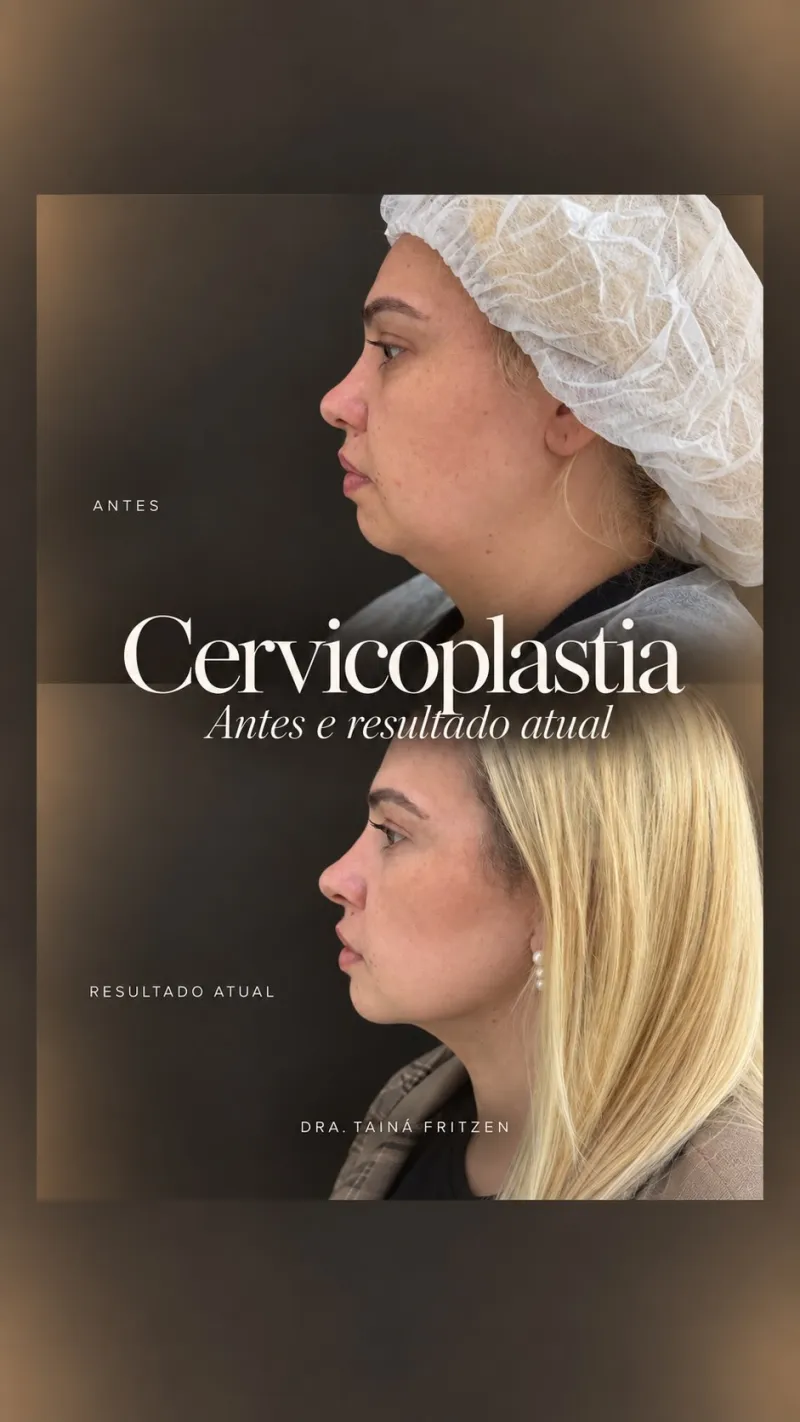 Before and after: Dr. Tainá Fritzen