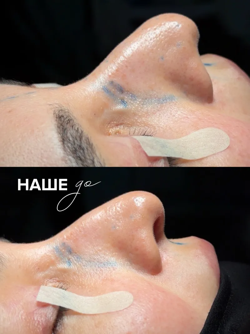 Before and after — Dr. Talgat Manatov