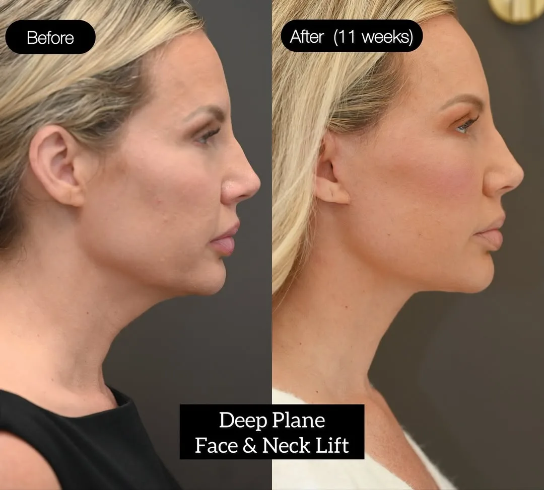 Before and after — Dr. Tareq Sawan