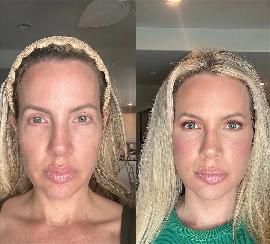 Before and after — Dr. Tareq Sawan