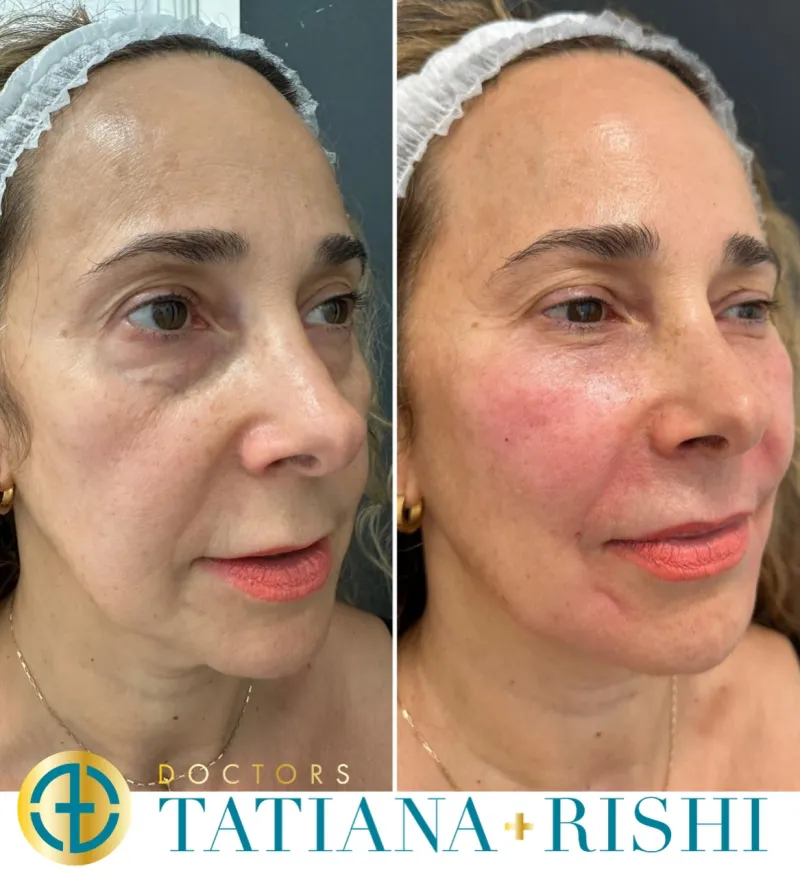 Before and after: Dr. Tatiana Lapa
