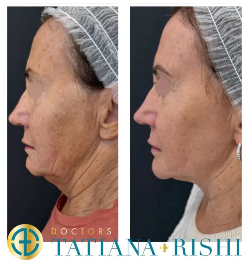 Before and after: Dr. Tatiana Lapa