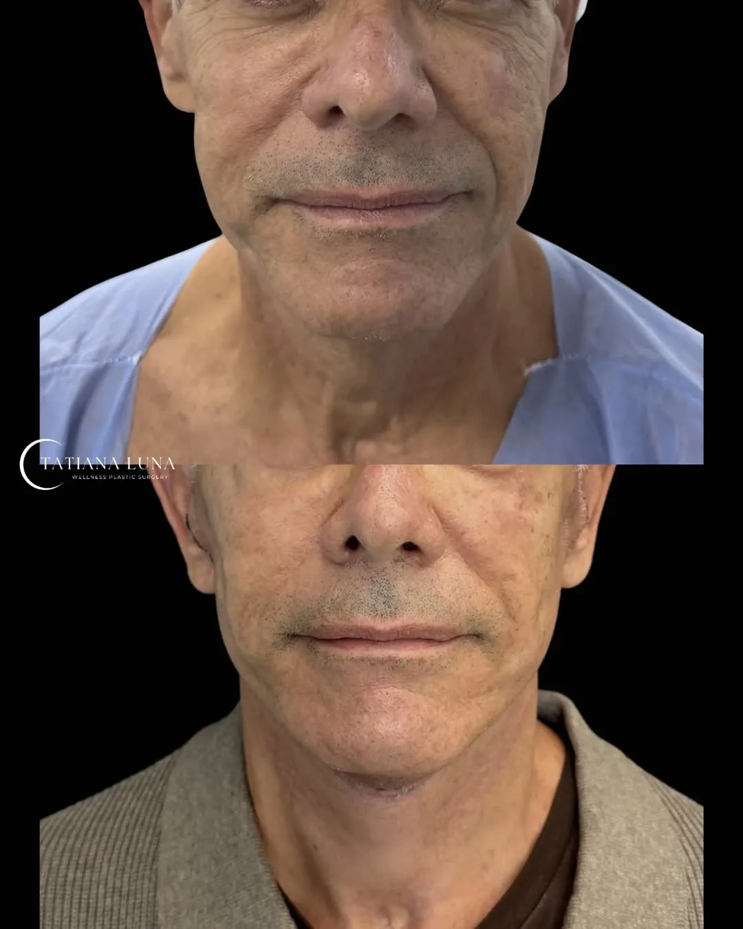 Before and after — Dr. Tatiana Luna