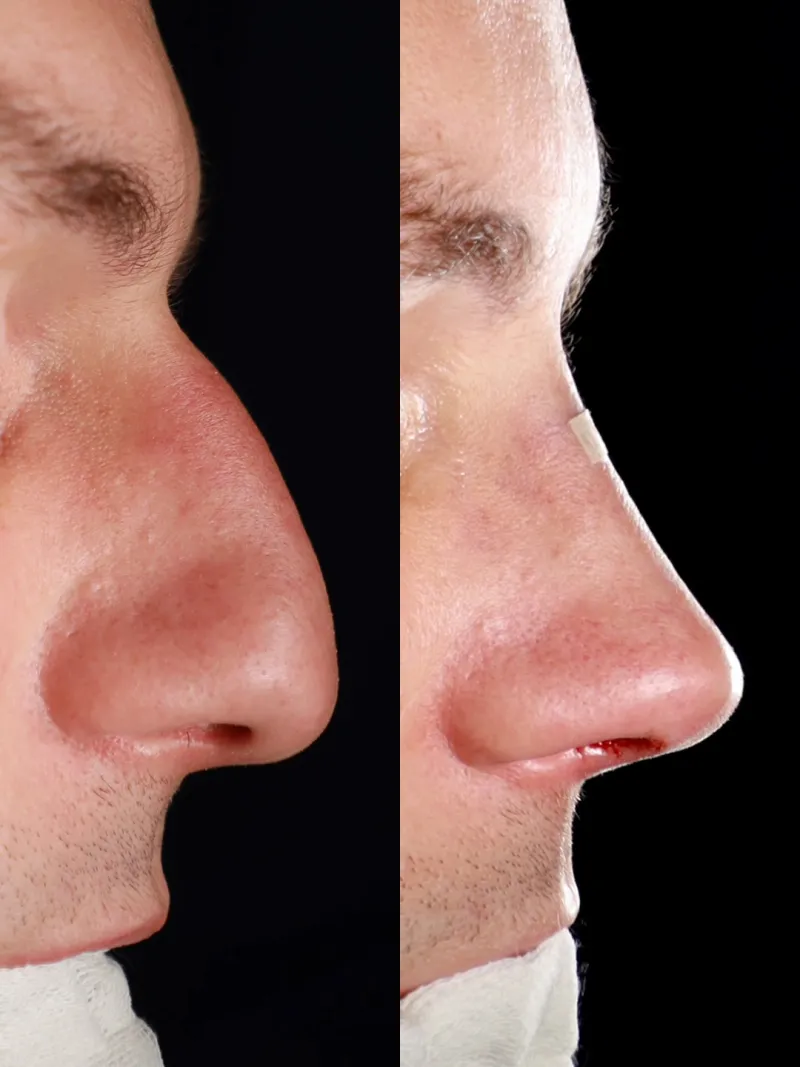 Before and after — Dr. Teoman Doğan