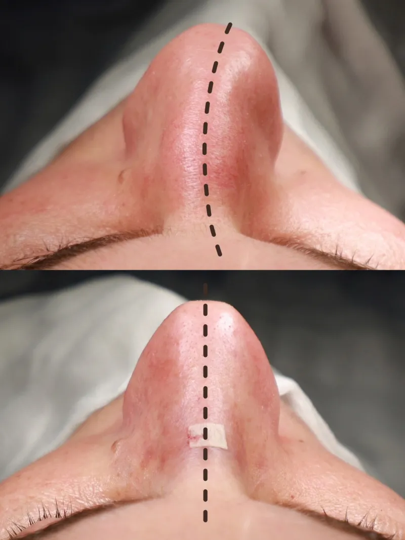 Before and after — Dr. Teoman Doğan