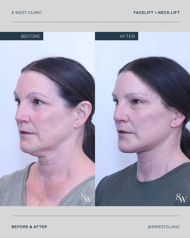 Before and after — Dr. Thomas Buonassisi