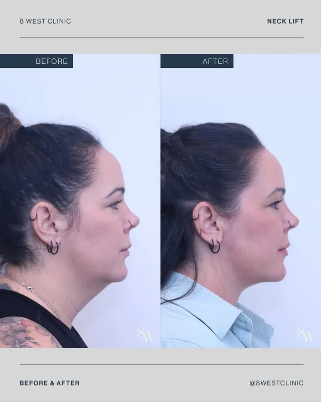 Before and after — Dr. Thomas Buonassisi