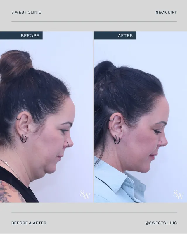 Before and after — Dr. Thomas Buonassisi