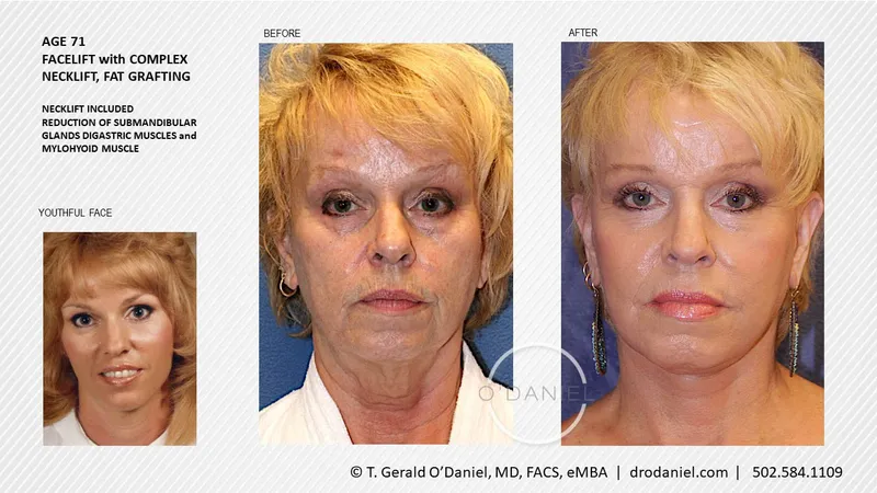 Before and after — Dr. Thomas Gerald O'Daniel