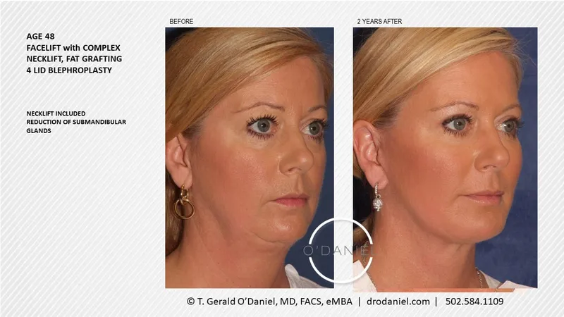 Before and after — Dr. Thomas Gerald O'Daniel