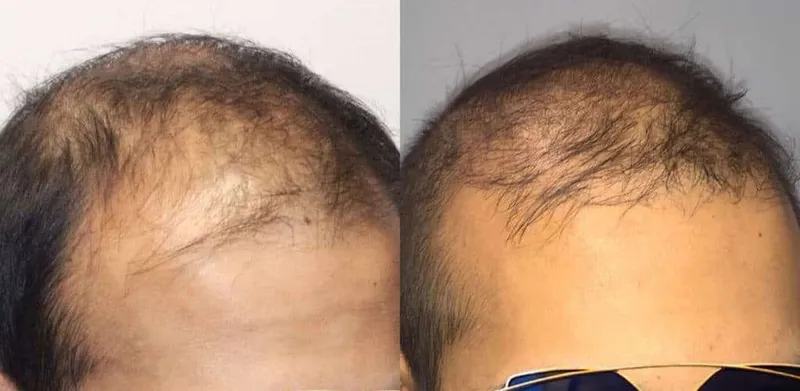 Before and after — Dr. Thomas Jeneby