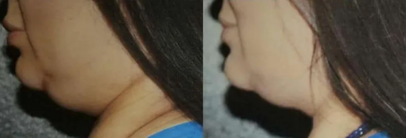 Before and after — Dr. Thomas Jeneby