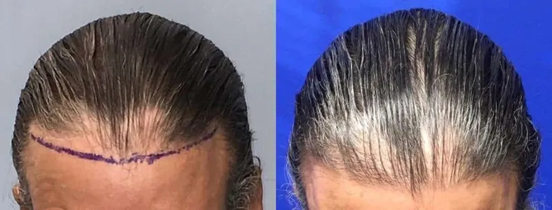 Before and after — Dr. Thomas Jeneby