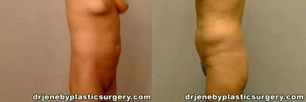 Before and after — Dr. Thomas Jeneby