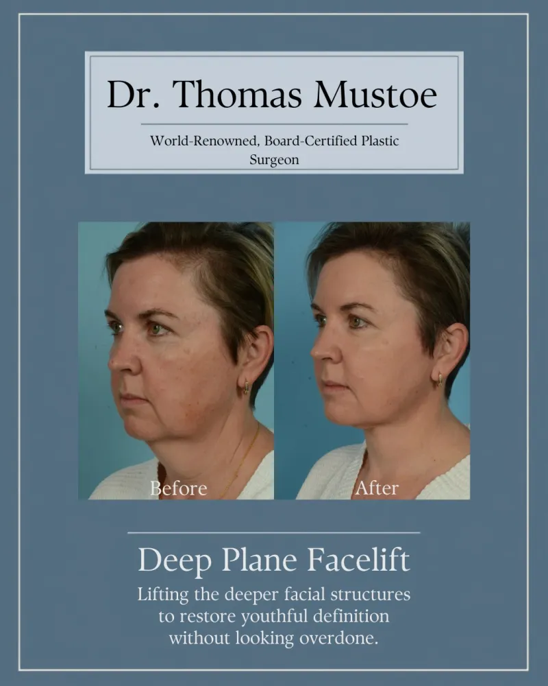 Before and after — Dr. Thomas Mustoe