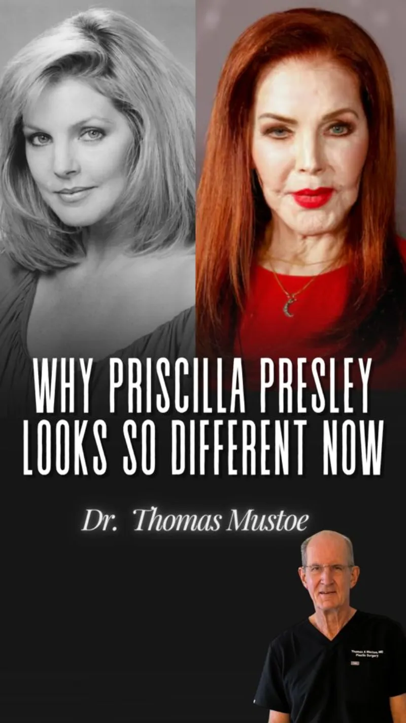 Before and after — Dr. Thomas Mustoe