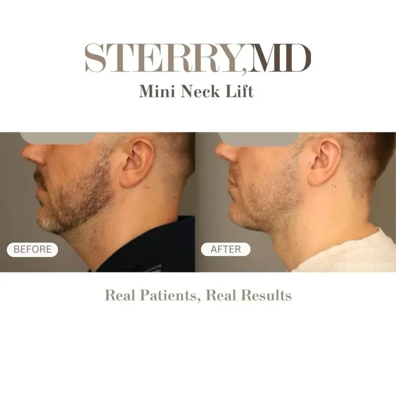 Before and after: Dr. Thomas Sterry