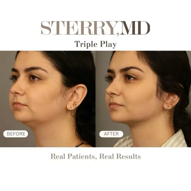Before and after: Dr. Thomas Sterry