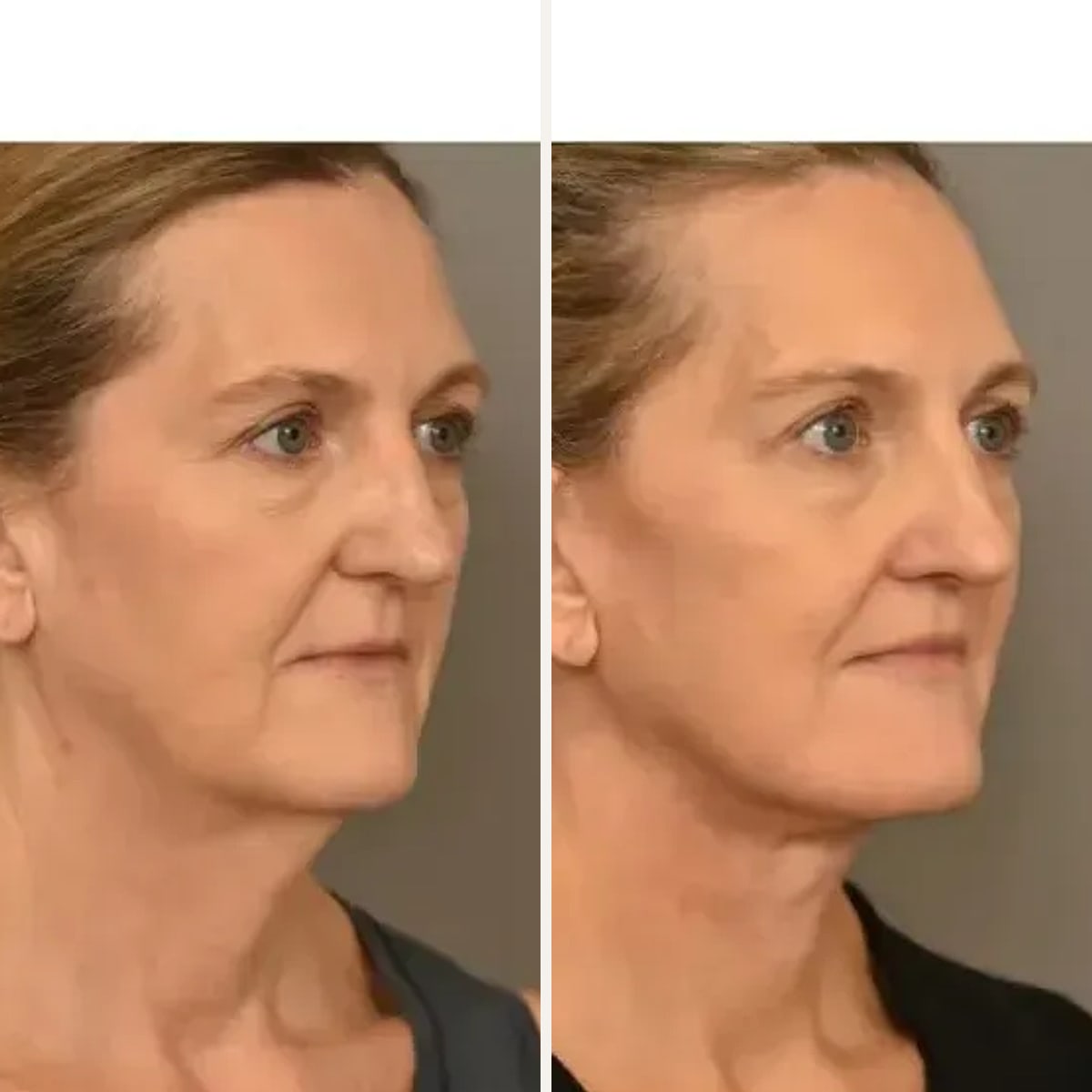 Before and after: Dr. Thomas Sterry