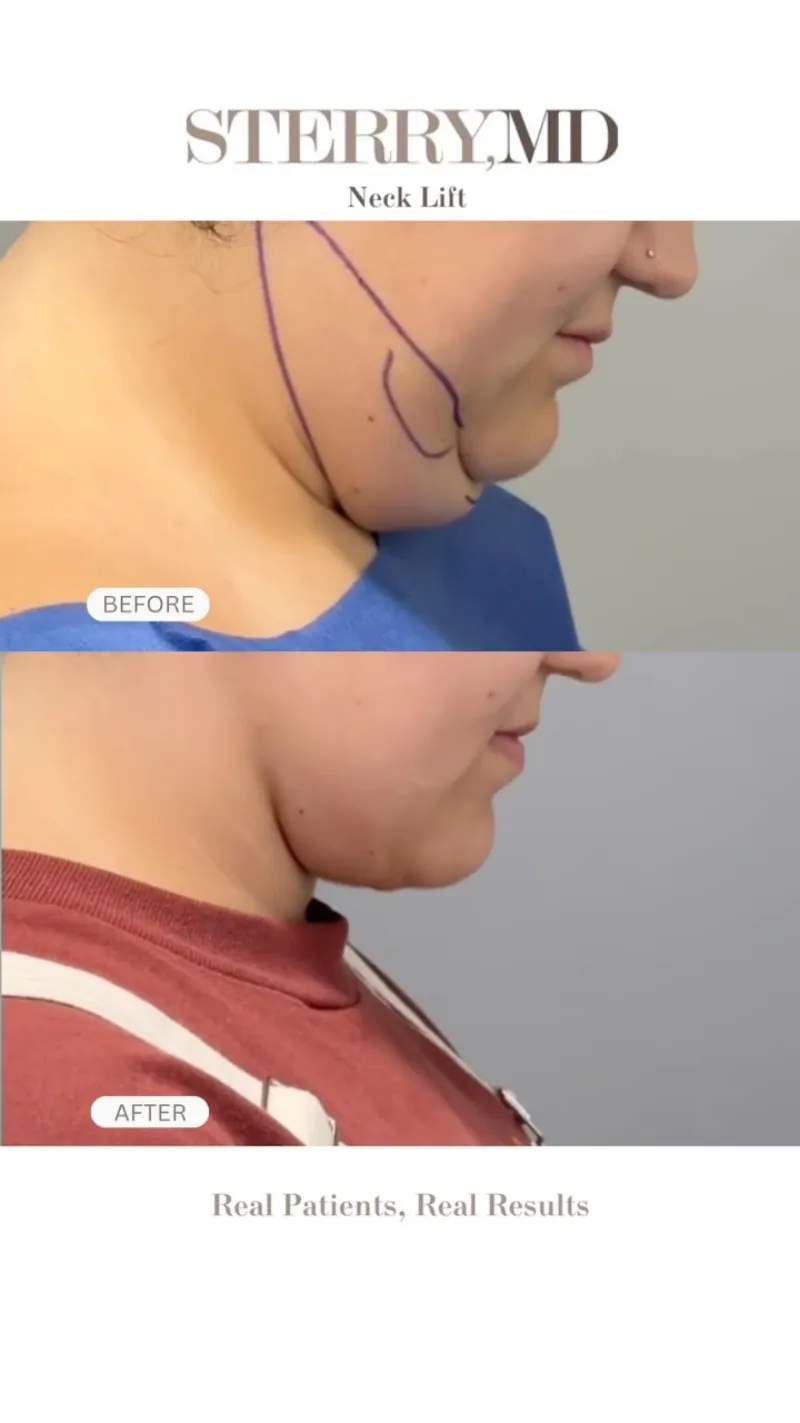 Before and after: Dr. Thomas Sterry