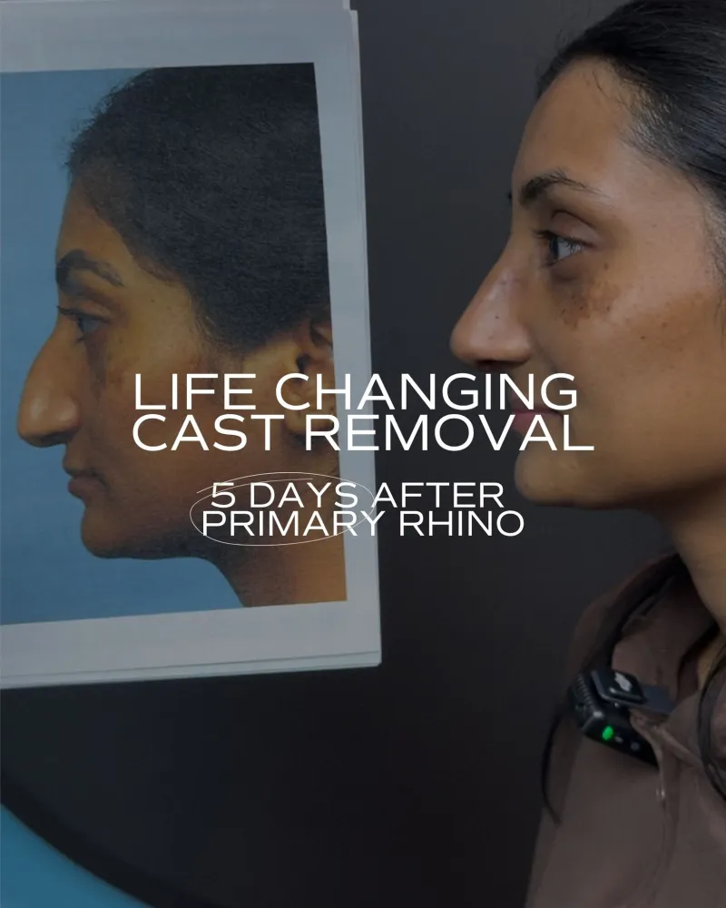 Before and after — Dr. Thomas Walker