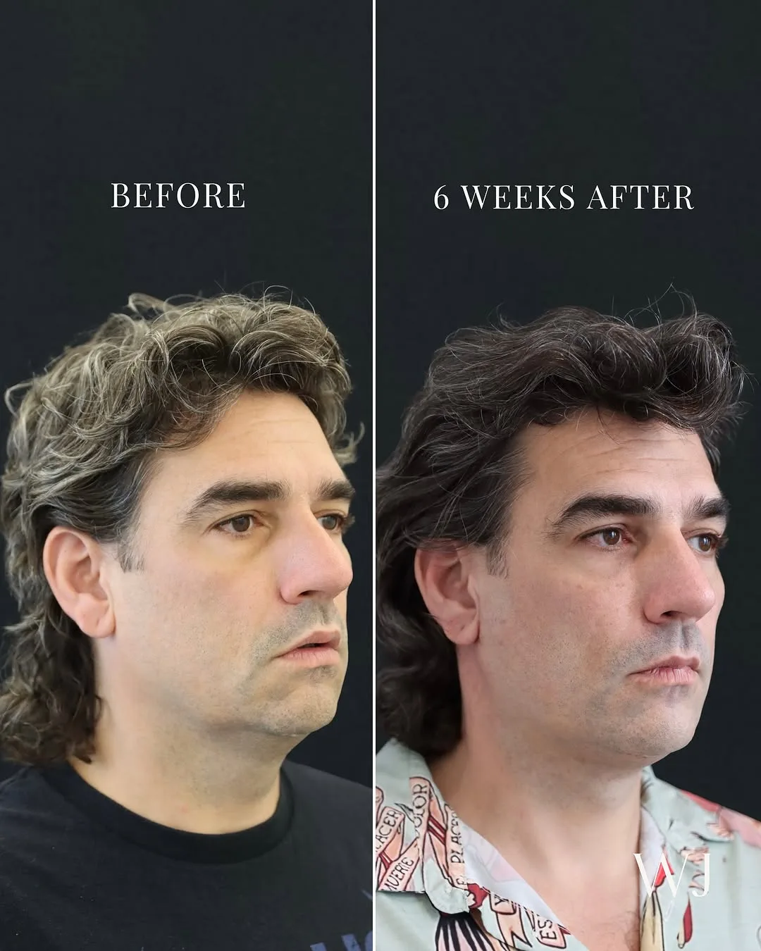 Before and after — Dr. Tim J. Janssen