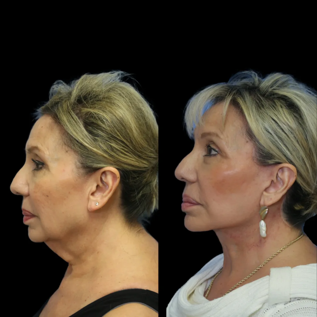 Before and after: Dr. Timothy Minton