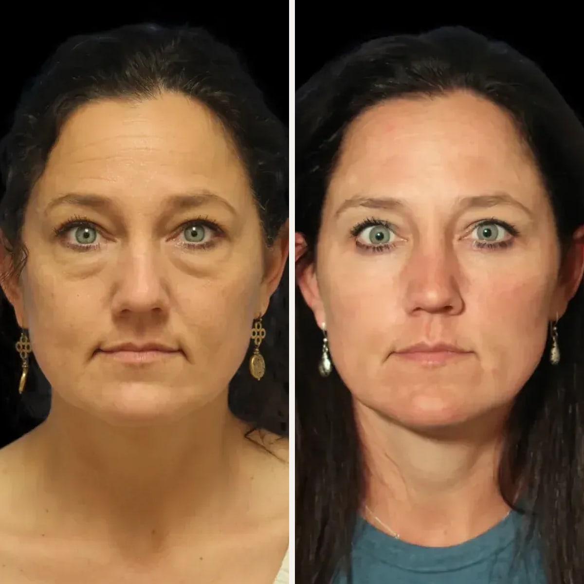 Before and after: Dr. Timothy Minton