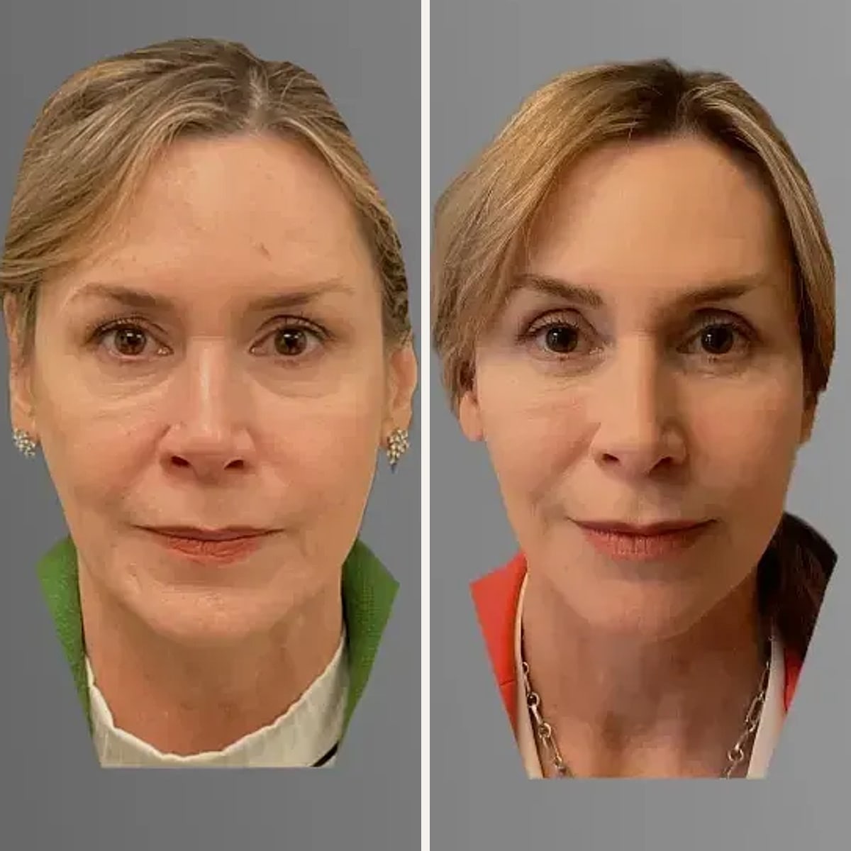 Before and after: Dr. Timothy Treece
