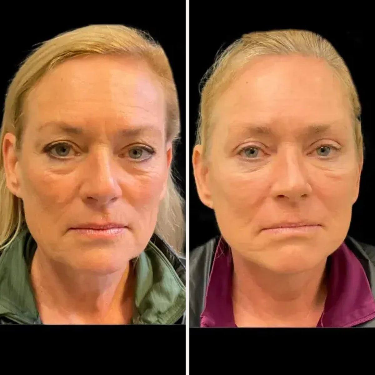 Before and after: Dr. Timothy Treece