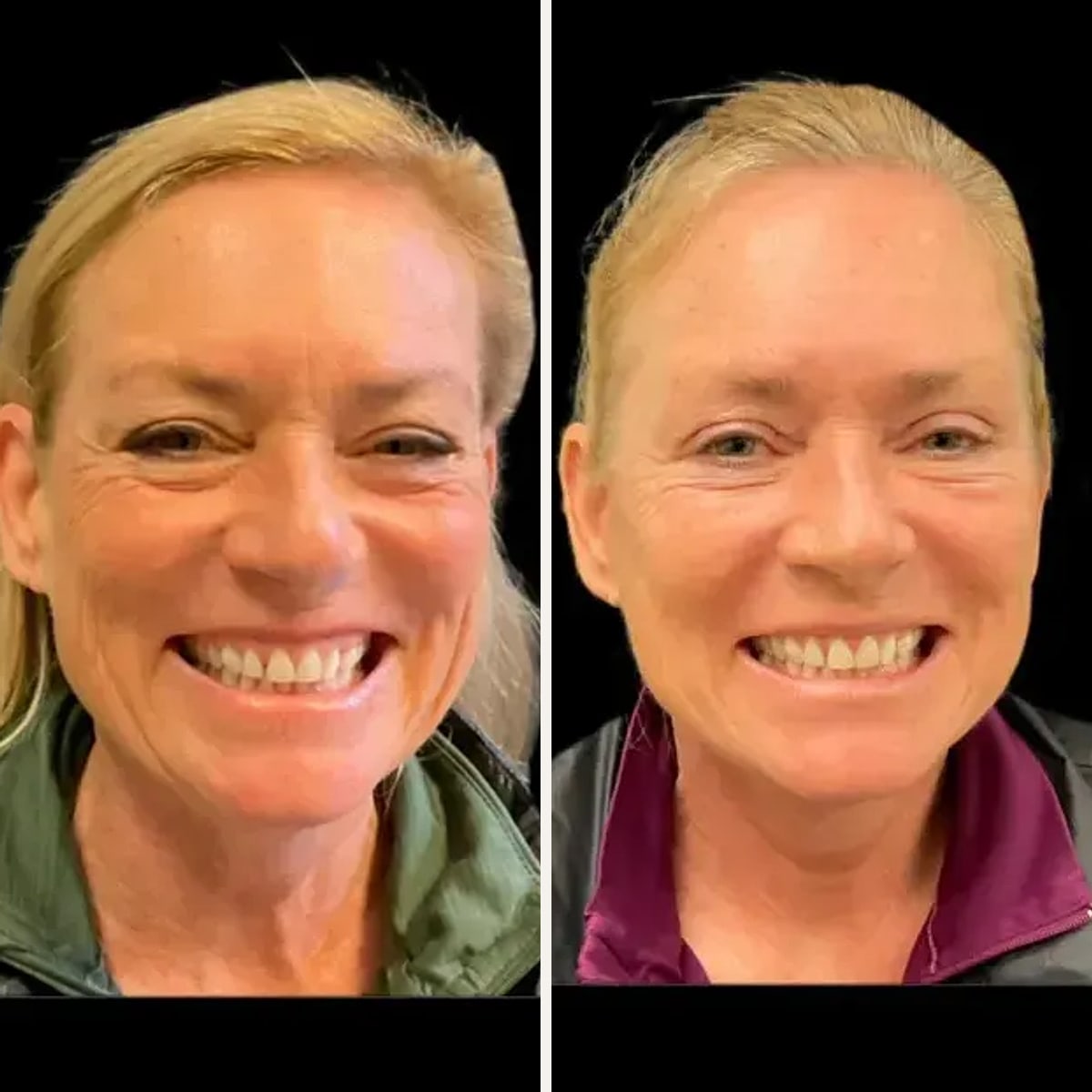 Before and after: Dr. Timothy Treece