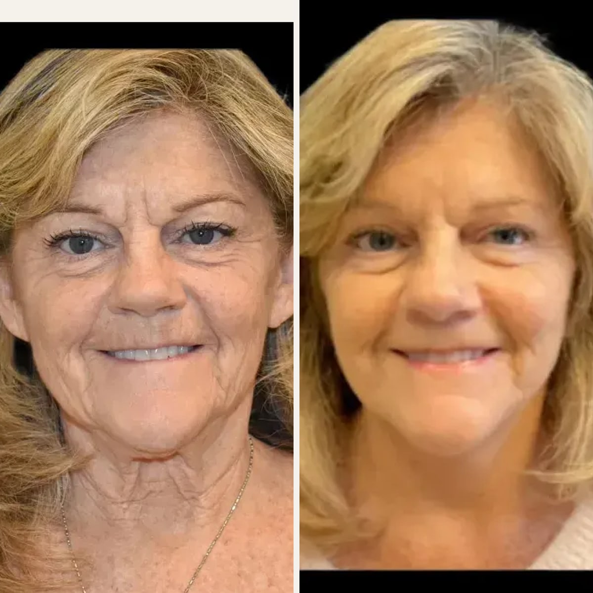 Before and after: Dr. Timothy Treece