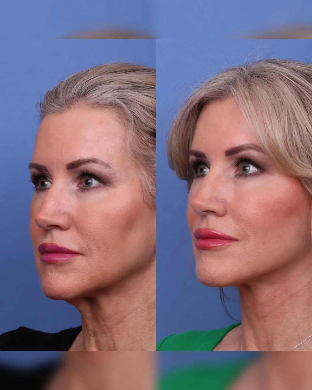 Before and after — Dr. Todd Hobgood