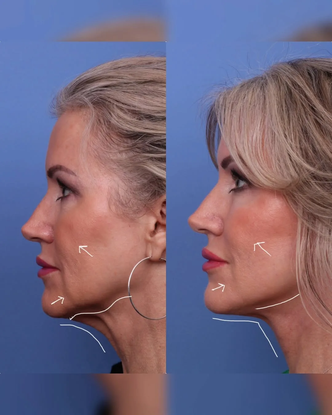 Before and after — Dr. Todd Hobgood