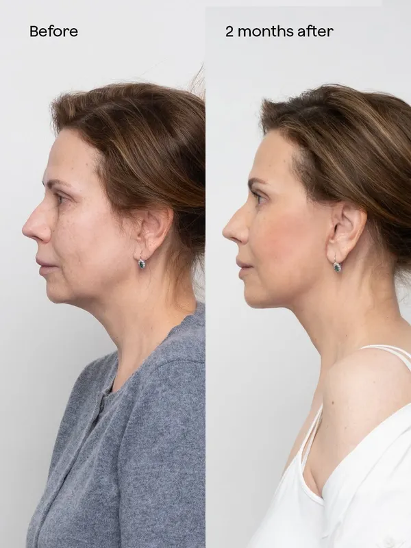 Before and after — Dr. Tomas Ventruba