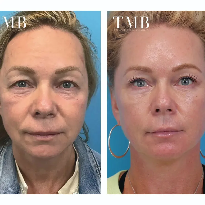 Before and after — Dr. Trevor Born