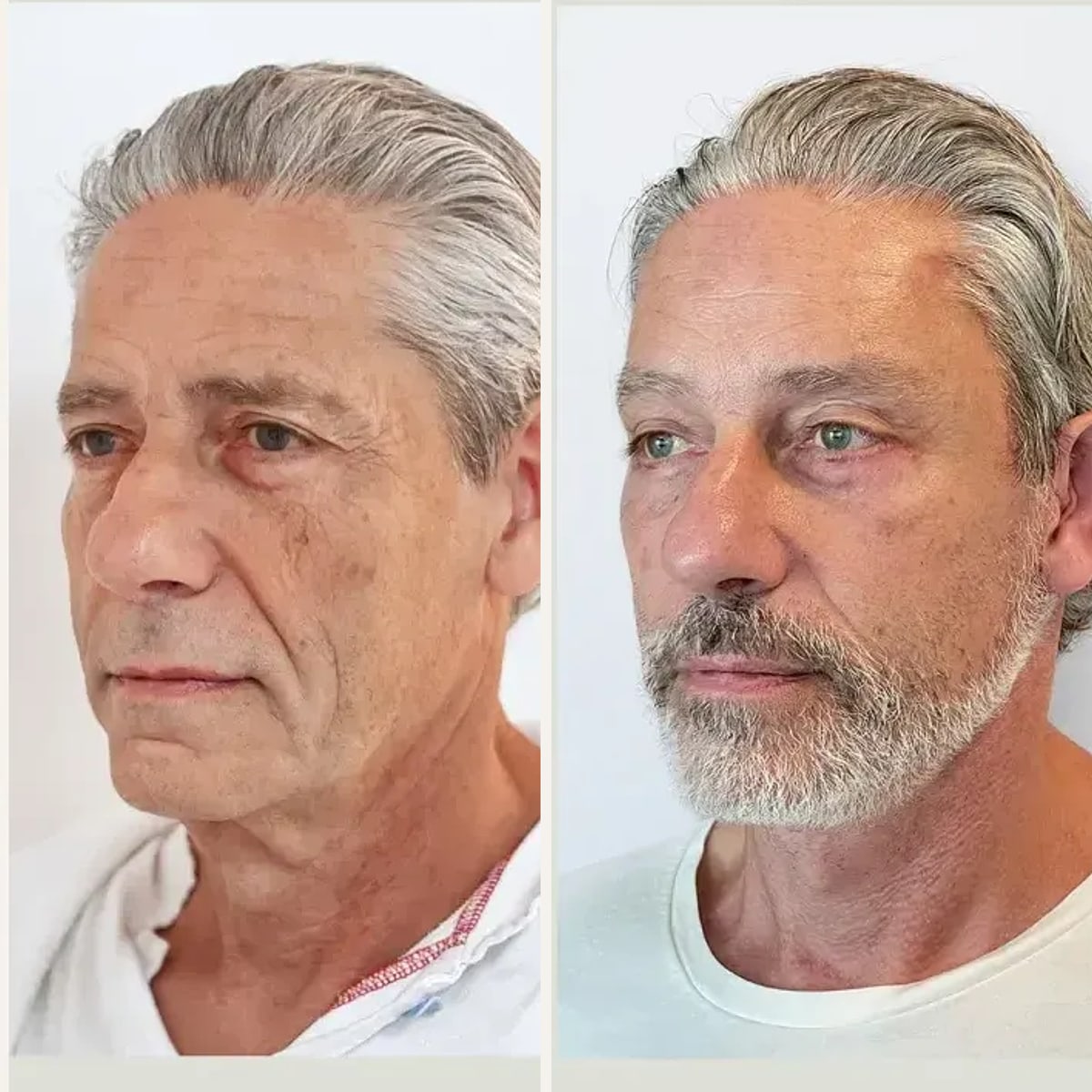 Before and after: Dr. Trine Henriksen