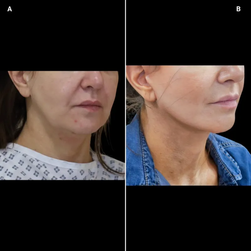 Before and after: Dr. Ullas Raghavan