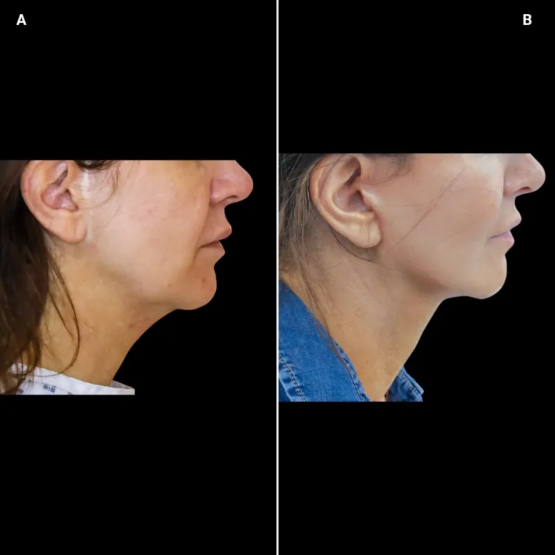 Before and after: Dr. Ullas Raghavan