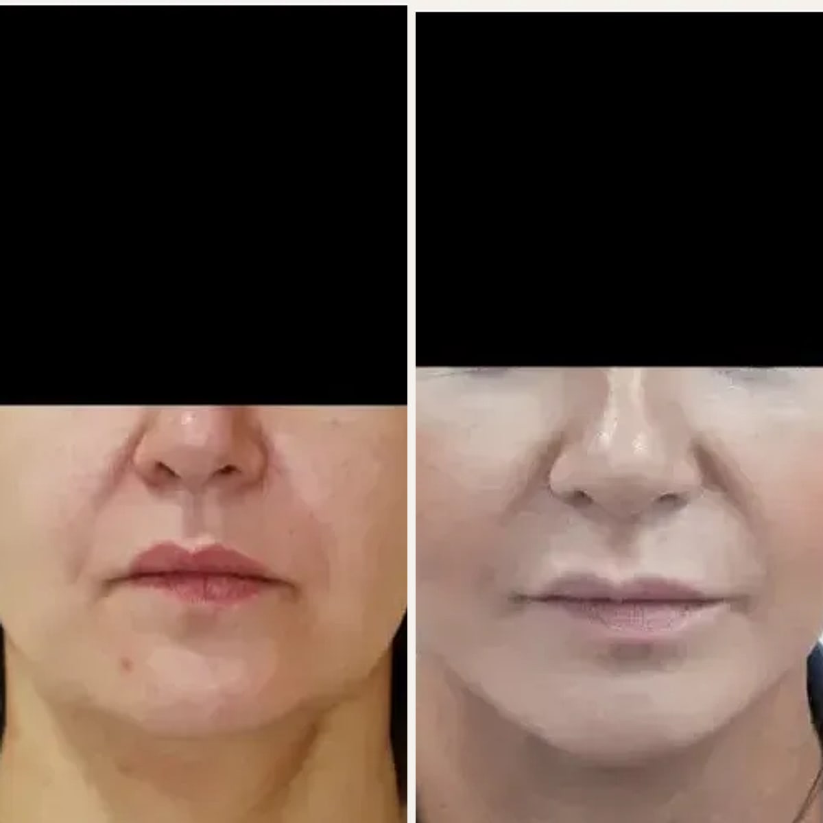 Before and after: Dr. Ullas Raghavan
