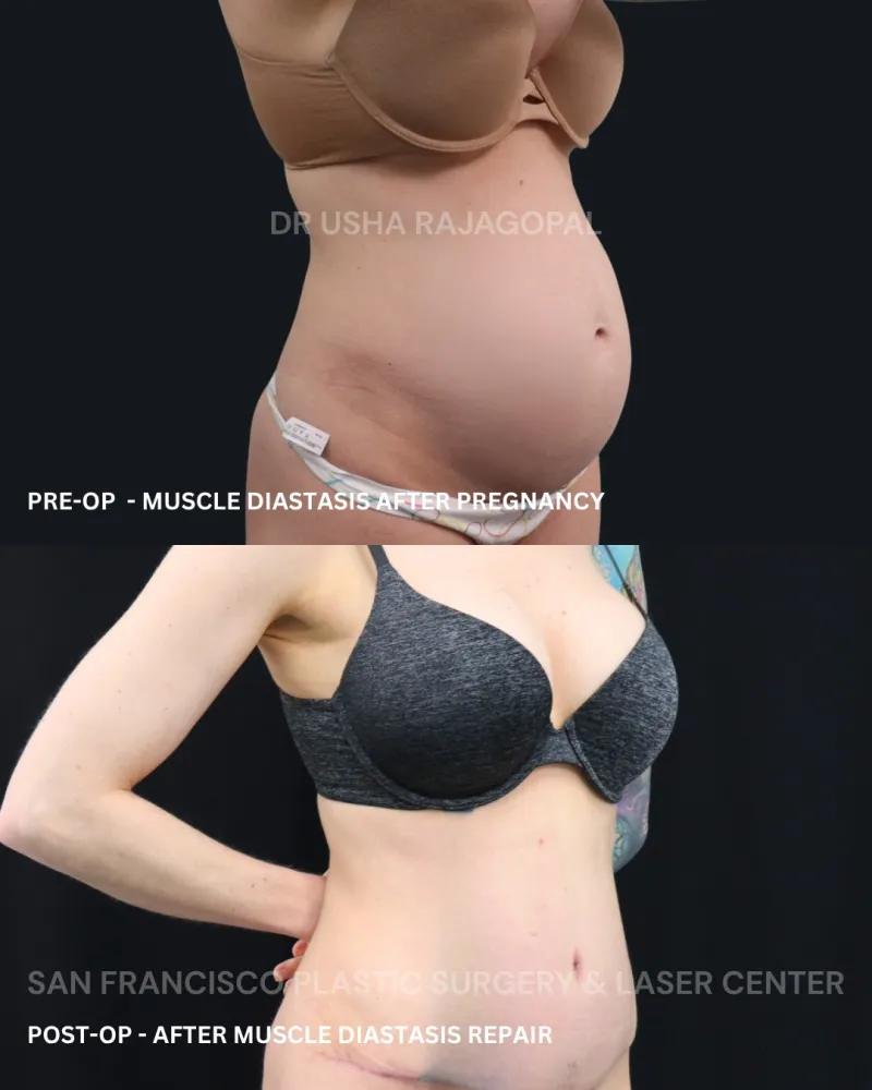 Before and after — Dr. Usha Rajagopal