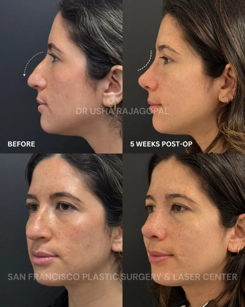 Before and after — Dr. Usha Rajagopal