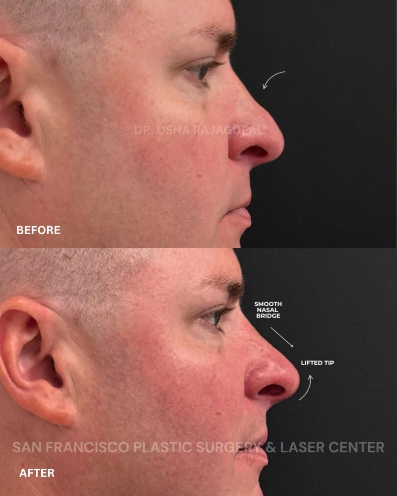 Before and after — Dr. Usha Rajagopal