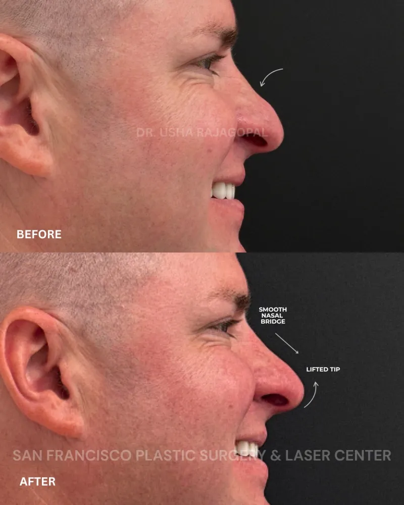 Before and after — Dr. Usha Rajagopal