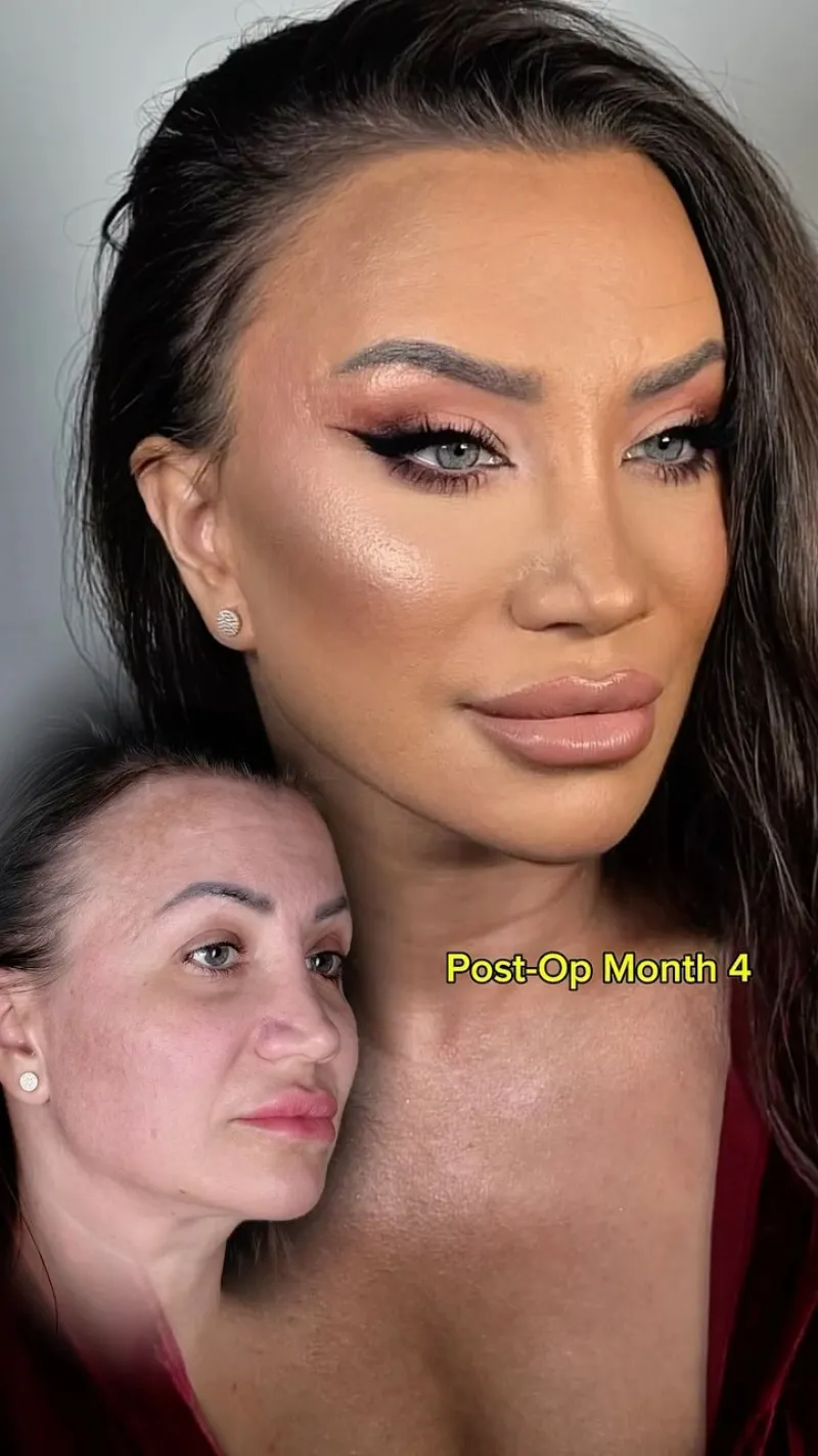Before and after — Dr. Vasfi Çelik